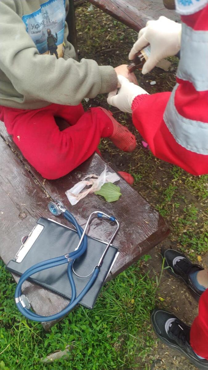На Дніпропетровщині внаслідок російського обстрілу поранено 8-річну дитину – ОВА