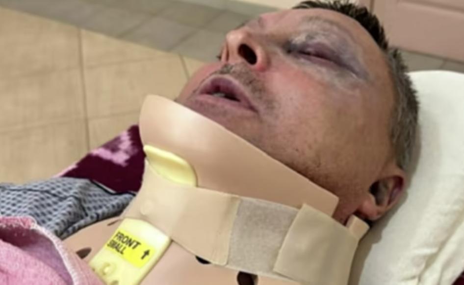 На Одещині зловмисники побили та пограбували військовослужбовця