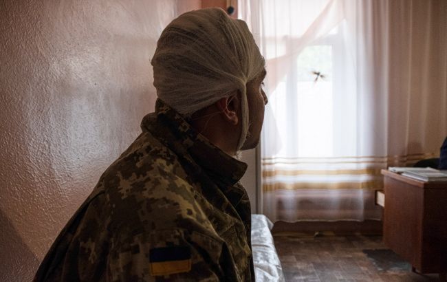 У МОЗ пояснили, як реагувати на людей з травмами обличчя чи ампутацією