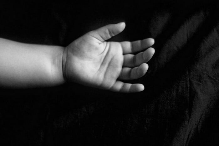 В Одесі пішла з життя дівчинка, яка наприкінці квітня потрапила під ворожий ракетний удар