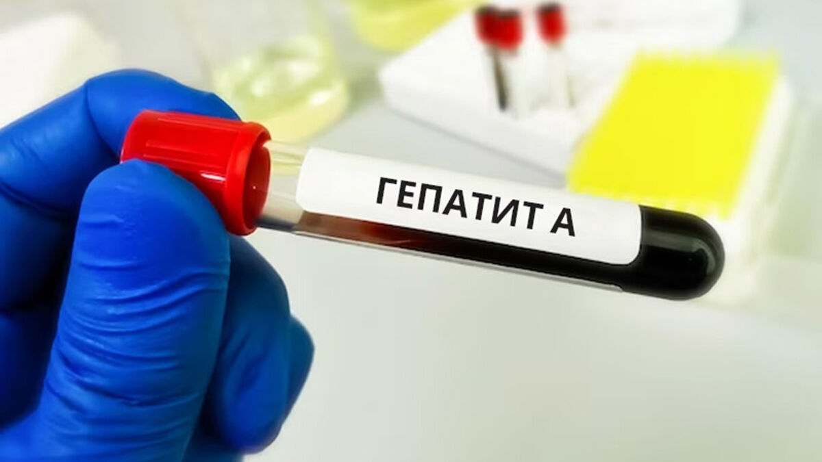 У столиці зафіксували спалах гепатиту A: детально про ситуацію