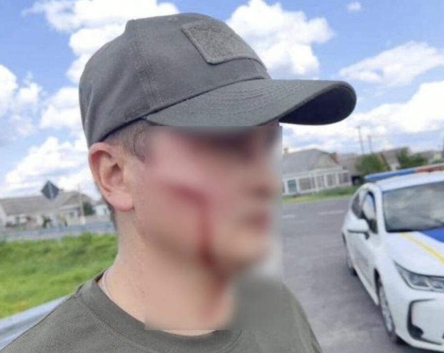 На Волині чоловік «говорив» з працівниками ТЦК за допомогою лопати (ВІДЕО)