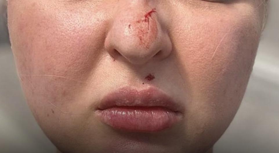 У Львові судять жінку, яка побила дружину військового